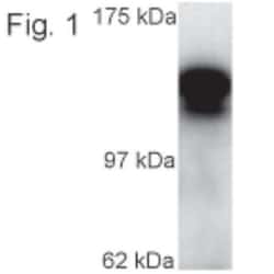 Kinesin 5C Antibody, Novus Biologicals 0.1mg; Unlabeled:Antibodies, Polyclonal