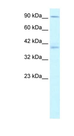 Kinesin C2 Antibody, Novus Biologicals 100&mu;L; Unlabeled:Antibodies,