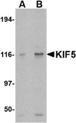 Kinesin 5A Antibody - BSA Free, Novus Biologicals 0.025 mg, Unconjugated:Antibodies,