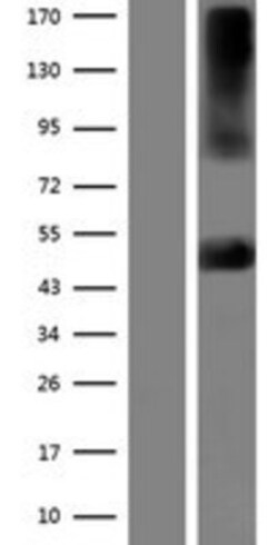 Novus Biologicals&trade;&nbsp;Kir2.2 Overexpression Lysate