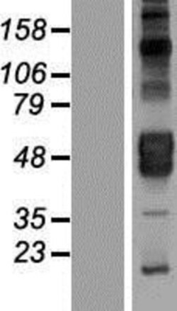 Novus Biologicals&trade;&nbsp;KIR2DL4/CD158d Overexpression Lysate