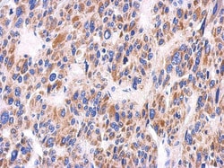 KIR2DS2 Antibody, Novus Biologicals 0.1 mL | Buy Online | Novus Biologicals | Fisher Scientific