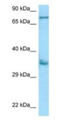 KIR2DS2 Antibody, Novus Biologicals 100&mu;L; Unlabeled:Antibodies, Polyclonal