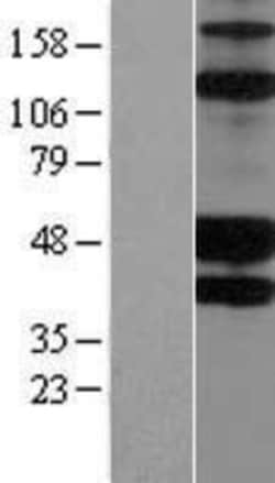 Novus Biologicals&trade;&nbsp;KIR2DS2 Overexpression Lysate