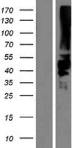 Novus Biologicals&trade;&nbsp;KIR2DS5/CD158g Overexpression Lysate