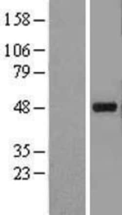 Novus Biologicals&trade;&nbsp;Kir3.4 Overexpression Lysate