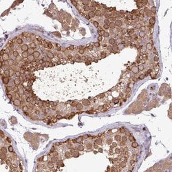 KIR3DX1 Antibody, Novus Biologicals:Antibodies:Primary Antibodies
