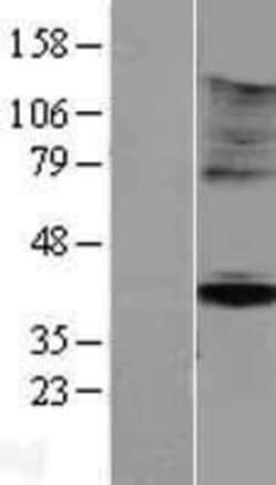 Novus Biologicals&trade;&nbsp;KIR5.1 Overexpression Lysate