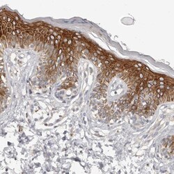 Kir6.1 Antibody, Novus Biologicals 0.1mL; Unlabeled:Antibodies, Polyclonal