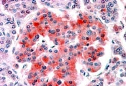 Kir6.2 Antibody, Novus Biologicals 0.1mg; Unlabeled:Antibodies, Polyclonal