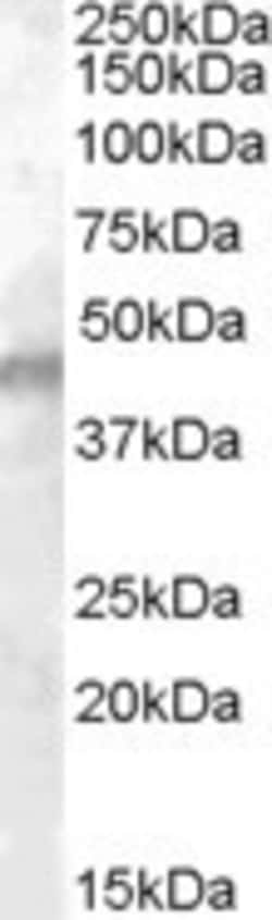 Kir6.2 Antibody, Novus Biologicals 0.1mg; Unlabeled:Antibodies, Polyclonal