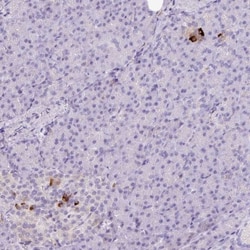 Kir6.2 Antibody, Novus Biologicals:Antibodies:Primary Antibodies