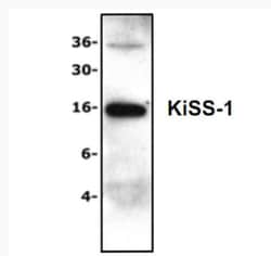 KISS1 Antibody, Novus Biologicals 0.025 mg; Unconjugated:Antibodies, Polyclonal
