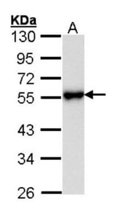 KiSS1R/GPR54 Antibody, Novus Biologicals 0.1mL; Unlabeled:Antibodies, Polyclonal