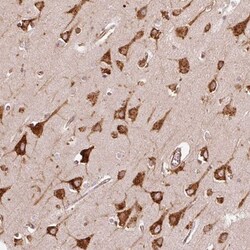 KLC1 Antibody, Novus Biologicals:Antibodies:Primary Antibodies