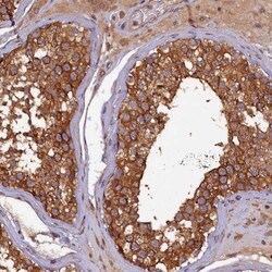 KLC2 Antibody, Novus Biologicals:Antibodies:Primary Antibodies