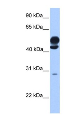 KLC3 Antibody, Novus Biologicals 100&mu;L; Unlabeled:Antibodies, Polyclonal