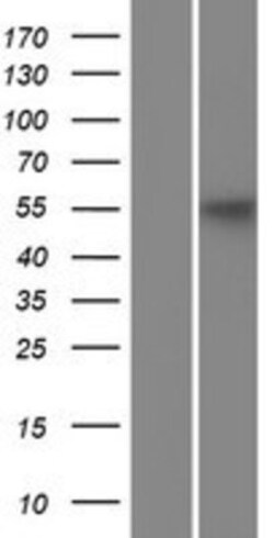Novus Biologicals&trade;&nbsp;KLC3 Overexpression Lysate