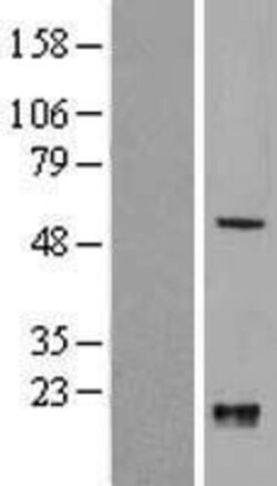 Novus Biologicals&trade;&nbsp;KLF10 Overexpression Lysate