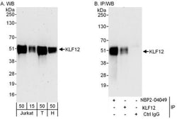 KLF12 Antibody, Novus Biologicals 0.1mg; Unlabeled:Antibodies, Polyclonal