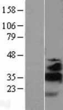 Novus Biologicals&trade;&nbsp;KLF13 Overexpression Lysate