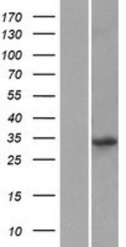Novus Biologicals™ KLF14 Overexpression Lysate