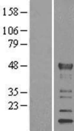 Novus Biologicals™ KLF15 Overexpression Lysate