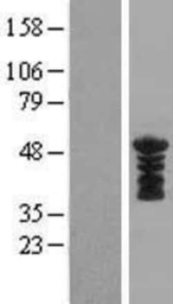 Novus Biologicals&trade;&nbsp;KLF17 Overexpression Lysate