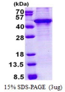 Novus Biologicals&trade;&nbsp;Recombinant Human KLF3 His Protein