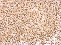 KLF5 Antibody, Novus Biologicals 0.1mg; Unlabeled:Antibodies, Polyclonal