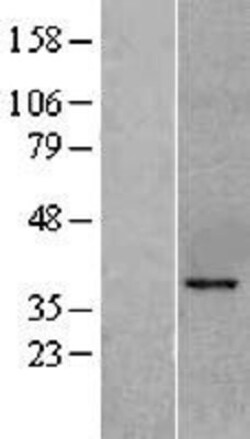 Novus Biologicals&trade;&nbsp;KLF6 Overexpression Lysate