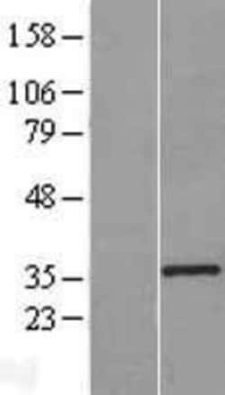 Novus Biologicals™ KLF7 Overexpression Lysate
