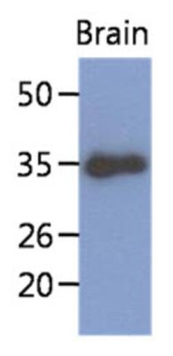KLF7 Antibody (3G3) - BSA Free, Novus Biologicals 100 &mu;L | Buy Online | Novus Biologicals | Fisher Scientific