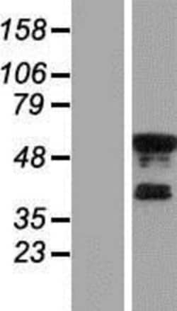 Novus Biologicals&trade;&nbsp;KLF8 Overexpression Lysate