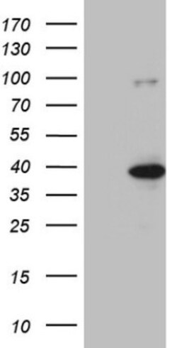 KLF9 Antibody (OTI8A11), Novus Biologicals 0.1mL; Unlabeled:Antibodies,