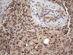 KLF9 Antibody (OTI8A11), Novus Biologicals 0.1mL; Unlabeled:Antibodies,