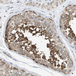 KLHDC10 Antibody, Novus Biologicals:Antibodies:Primary Antibodies
