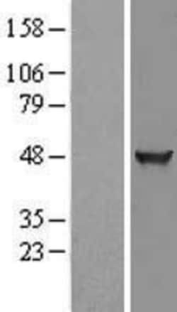 Novus Biologicals&trade;&nbsp;KLHDC2 Overexpression Lysate