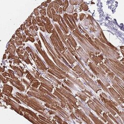 KLHDC2 Antibody, Novus Biologicals:Antibodies:Primary Antibodies
