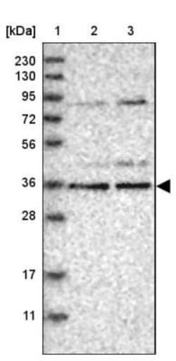KLHDC3 Antibody, Novus Biologicals 25 &mu;L; Unlabeled:Antibodies, Polyclonal