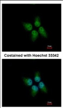 KLHDC4 Antibody, Novus Biologicals™