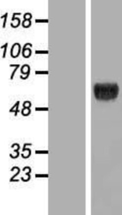 Novus Biologicals™ KLHDC4 Overexpression Lysate