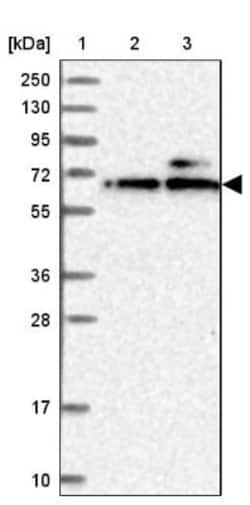 KLHDC4 Antibody, Novus Biologicals 25 &mu;L; Unlabeled:Antibodies, Polyclonal