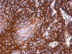 KLHDC5 Antibody, Novus Biologicals 0.1mL; Unlabeled:Antibodies, Polyclonal