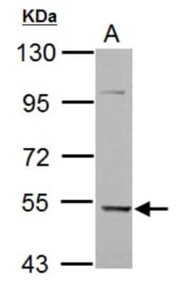KLHDC5 Antibody, Novus Biologicals 0.1mL; Unlabeled:Antibodies, Polyclonal