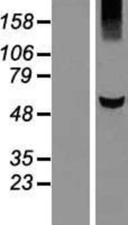 Novus Biologicals&trade;&nbsp;KLHDC5 Overexpression Lysate