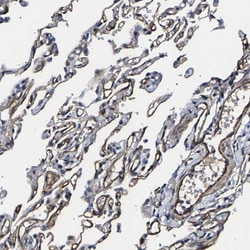 KLHDC5 Antibody, Novus Biologicals:Antibodies:Primary Antibodies
