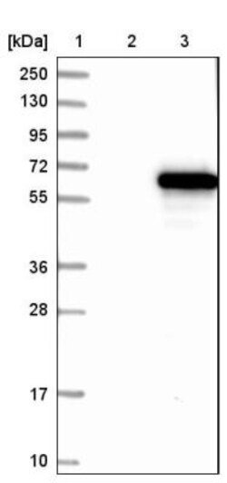 KLHDC5 Antibody, Novus Biologicals:Antibodies:Primary Antibodies