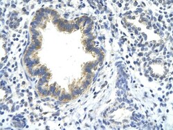 KLHDC8A Antibody, Novus Biologicals:Antibodies:Primary Antibodies
