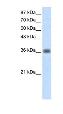 KLHDC8A Antibody, Novus Biologicals:Antibodies:Primary Antibodies